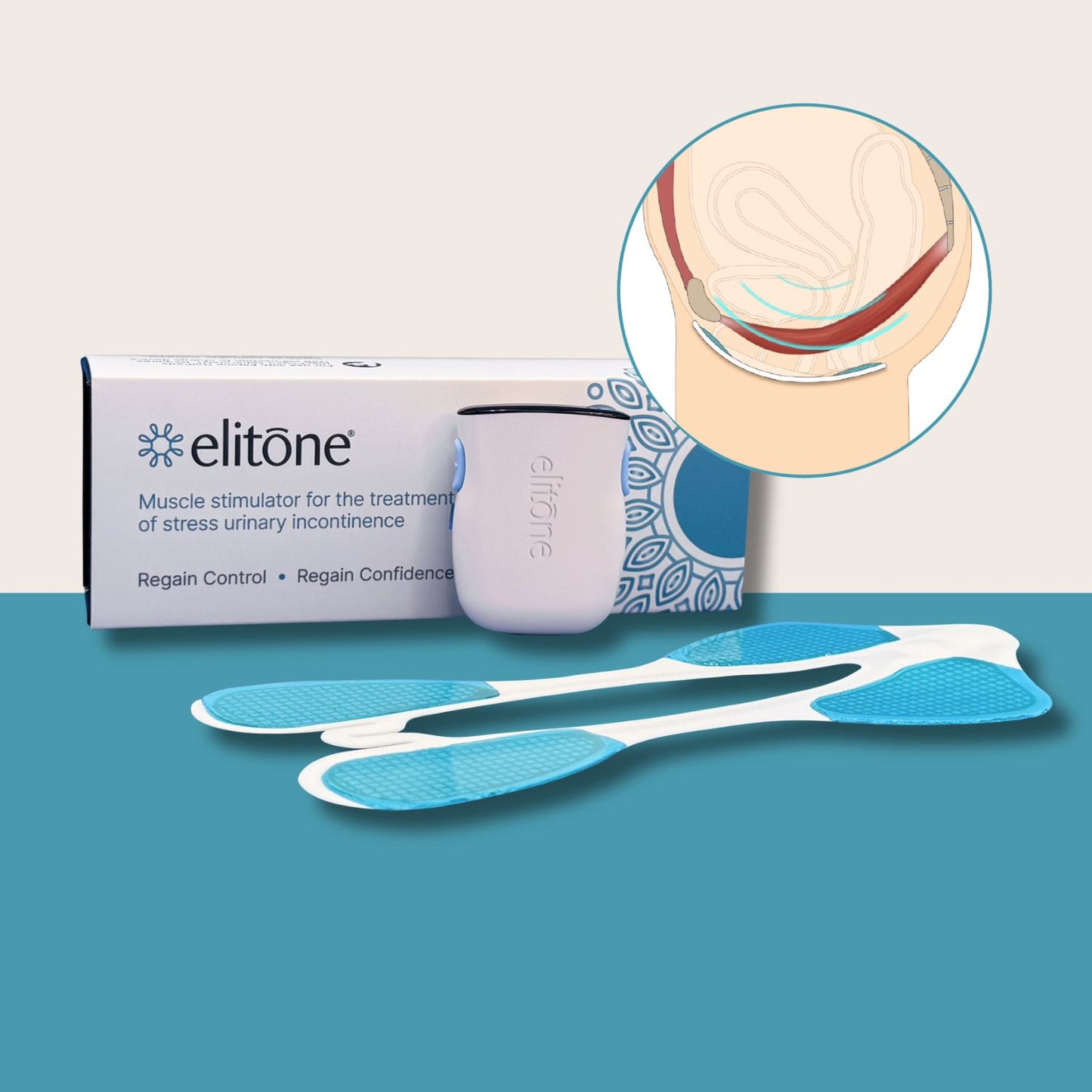Elitone Treatment